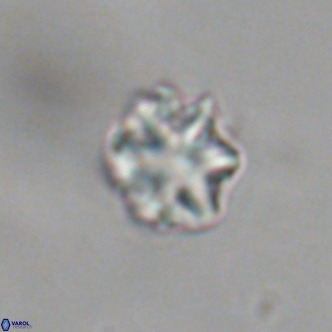 Discoaster puvillandii VR 18988