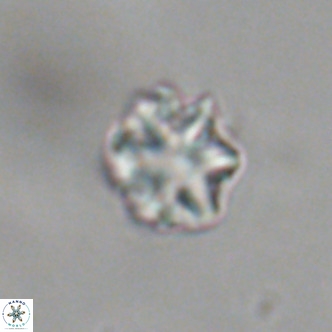 Discoaster puvillandii VR 18988
