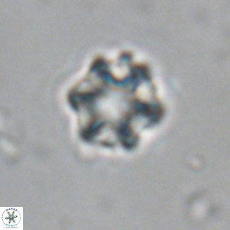 Discoaster puvillandii VR 18982