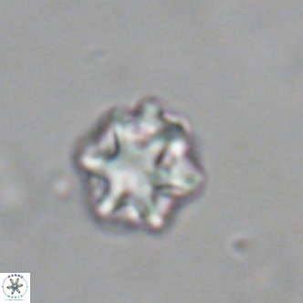 Discoaster puvillandii VR 18983