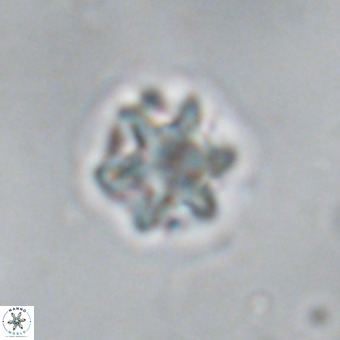 Discoaster puvillandii VR 18990