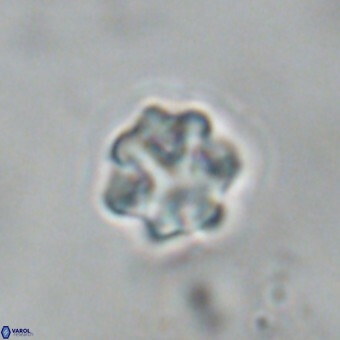 Discoaster puvillandii VR 18991