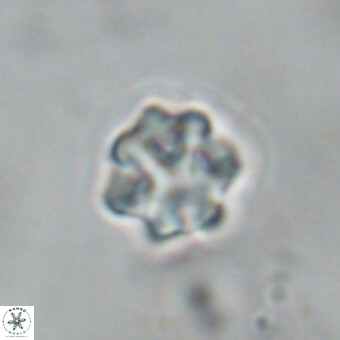 Discoaster puvillandii VR 18991