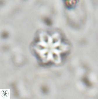 Olladiscoaster lepidus 30507