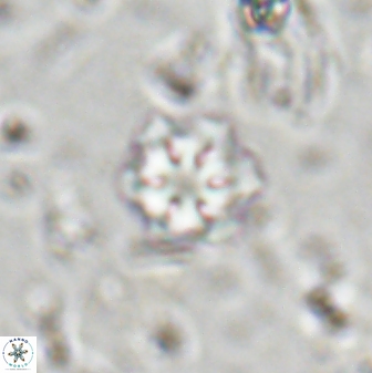 Olladiscoaster lepidus 30508