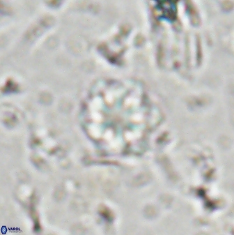 Olladiscoaster lepidus 30509