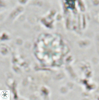 Olladiscoaster lepidus 30509