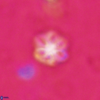 Olladiscoaster lepidus 30514