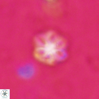 Olladiscoaster lepidus 30514
