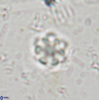 Olladiscoaster lepidus 30516