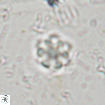 Olladiscoaster lepidus 30516