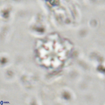 Olladiscoaster lepidus 30517