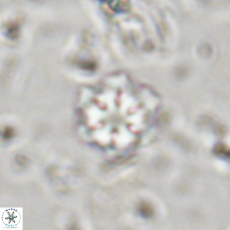 Olladiscoaster lepidus 30517