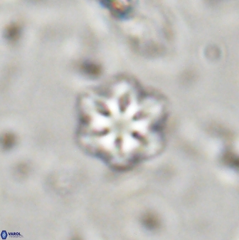 Olladiscoaster lepidus 30518