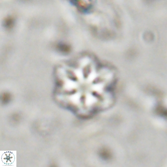 Olladiscoaster lepidus 30518