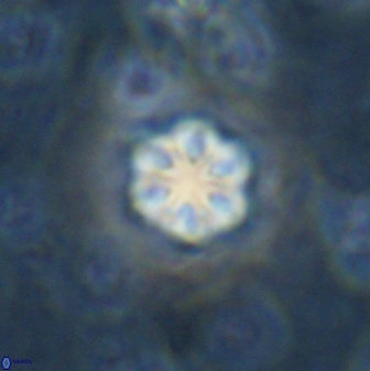 Olladiscoaster lepidus 30519