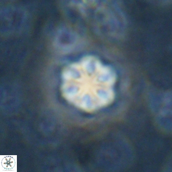 Olladiscoaster lepidus 30519