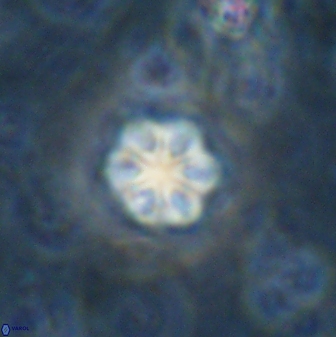 Olladiscoaster lepidus 30510