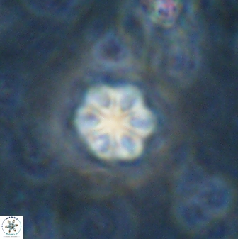Olladiscoaster lepidus 30510