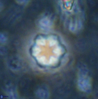 Olladiscoaster lepidus 30511