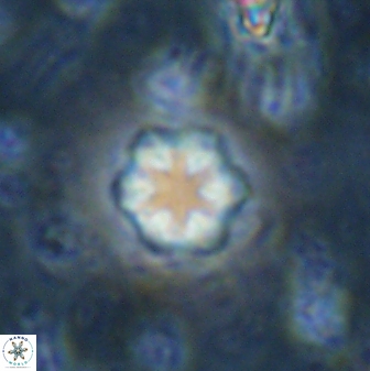 Olladiscoaster lepidus 30511