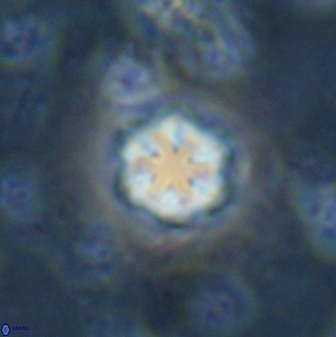 Olladiscoaster lepidus 30520