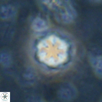 Olladiscoaster lepidus 30520