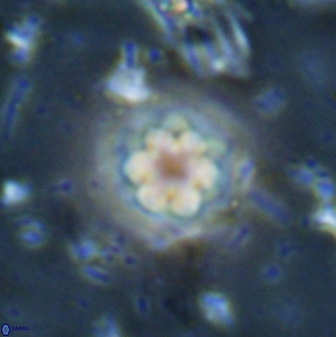 Olladiscoaster lepidus 30521