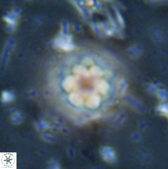 Olladiscoaster lepidus 30521
