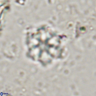 Olladiscoaster lepidus 30597