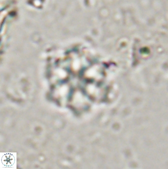 Olladiscoaster lepidus 30597