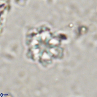 Olladiscoaster lepidus 30598