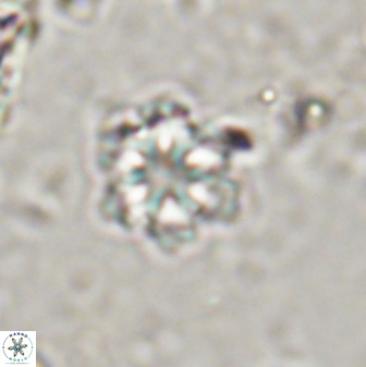 Olladiscoaster lepidus 30598