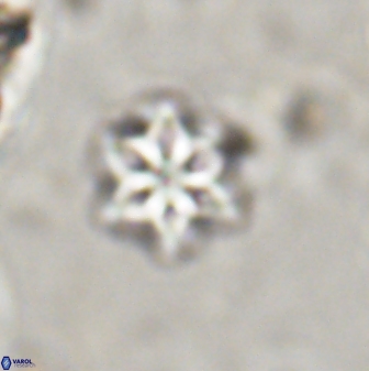 Olladiscoaster lepidus 30599