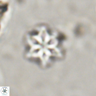 Olladiscoaster lepidus 30599