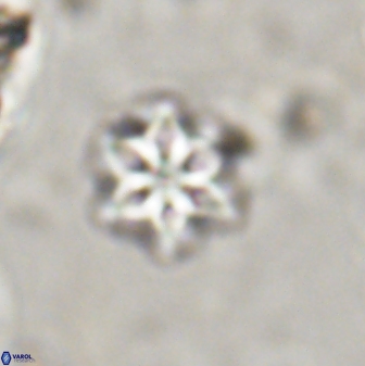 Olladiscoaster lepidus 30604