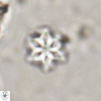 Olladiscoaster lepidus 30604