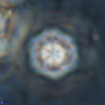 Olladiscoaster lepidus 30605