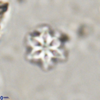 Olladiscoaster lepidus 30600