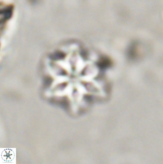 Olladiscoaster lepidus 30600