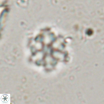 Olladiscoaster lepidus 30601