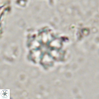 Olladiscoaster lepidus 30602