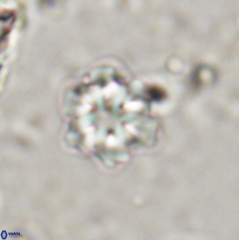 Olladiscoaster lepidus 30603