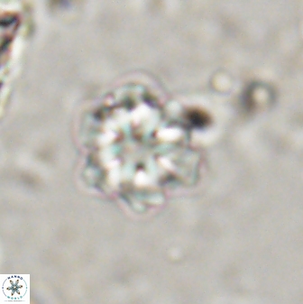 Olladiscoaster lepidus 30603