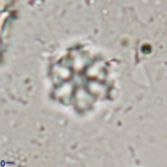 Olladiscoaster lepidus 30615