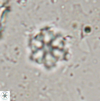 Olladiscoaster lepidus 30615