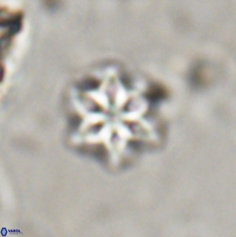 Olladiscoaster lepidus 30616