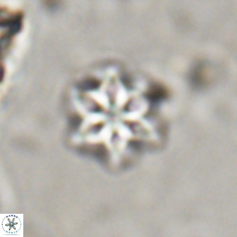 Olladiscoaster lepidus 30616