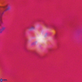 Olladiscoaster lepidus 30617