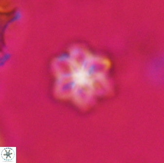 Olladiscoaster lepidus 30617
